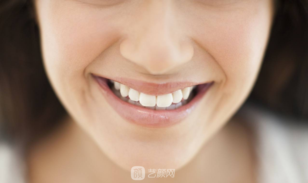 美齒冠是什么 讓你瞬間擁有明星氣質(zhì)