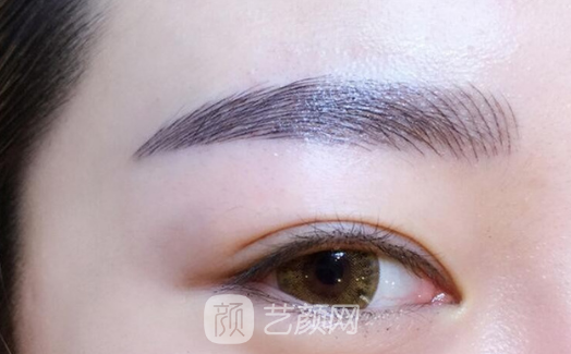 雙眼皮修復(fù)手術(shù)為什么這么難?