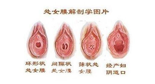 阜新修復(fù)處女膜哪好?