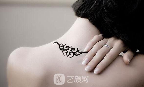 合肥激光除紋身去哪里做