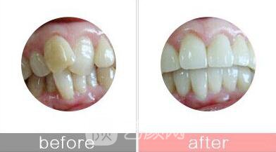 衡陽(yáng)市牙齒整形選哪家醫(yī)院好