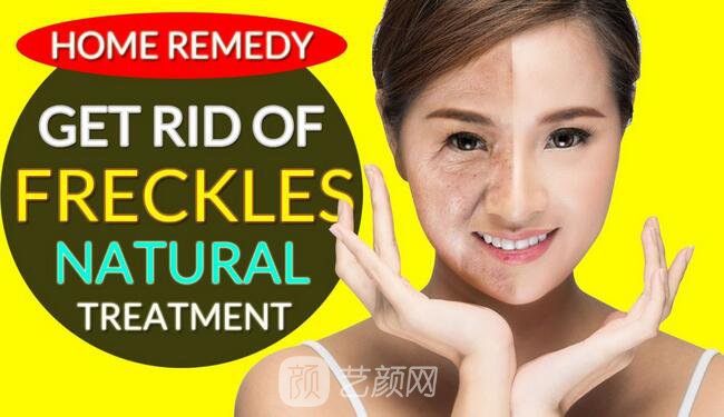 湖南激光祛斑好嗎？