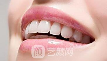 連云港牙齒整形選哪家醫(yī)院?我們一起來分析一下