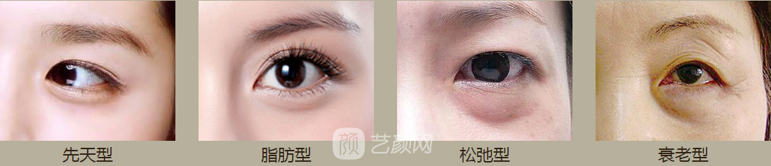 洛陽做眼袋哪里好，費(fèi)用如何