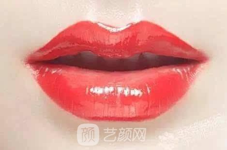 青島伊美爾豐唇果如何?