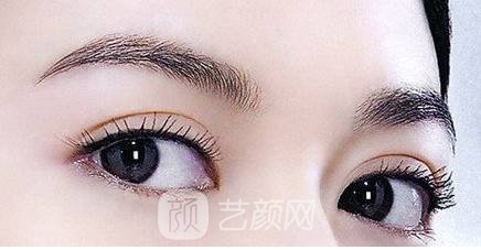 山東濱州雙眼皮手術(shù)貴嗎?多少錢?