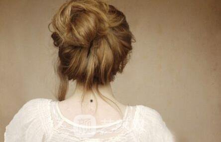 西安那里去痣更好，讓我這個(gè)專業(yè)醫(yī)生來告訴你