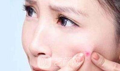 丹東哪去痘比較好?當(dāng)?shù)厍竺勒邅?lái)告訴你