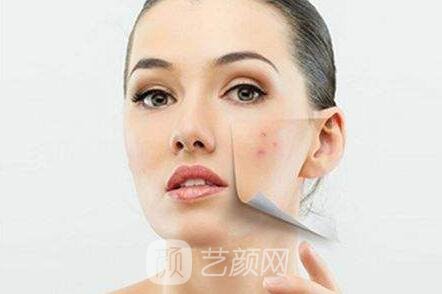 丹東哪去痘比較好?當(dāng)?shù)厍竺勒邅?lái)告訴你