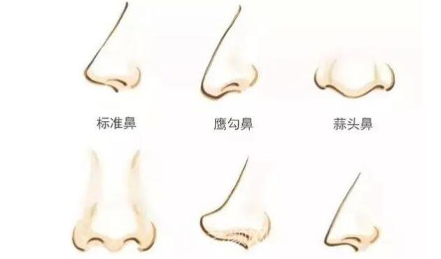 綿陽(yáng)微晶石隆鼻多少錢(qián)