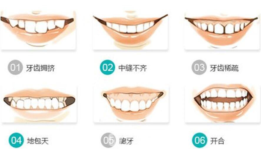 如何阻止地包天的發(fā)生，專業(yè)醫(yī)生為你解答