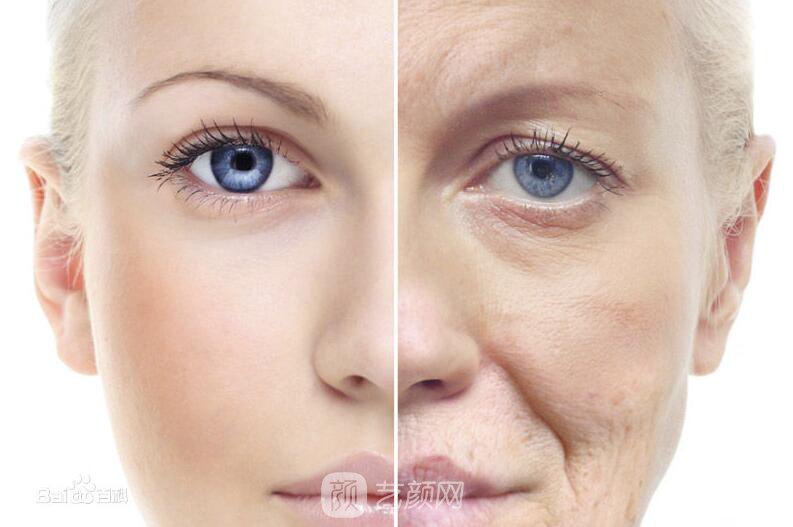 面部美容去皺果怎樣?請看真人案例