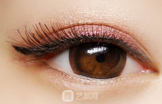 韓式切開雙眼皮的真實過程及恢復(fù)體驗分享~~