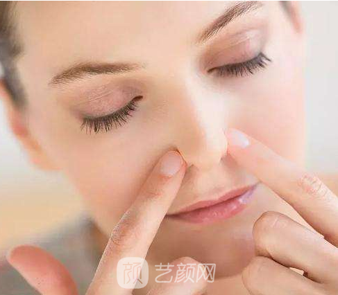 隆鼻失敗修復(fù)案例終于擁有滿意的鼻形