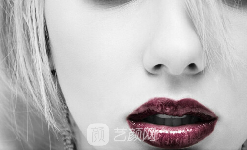 隆鼻果出來了朋友們都說好，大家如何看呢？