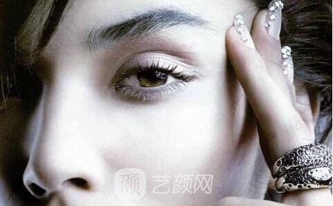 全切雙眼皮手術(shù)案例,全切雙眼皮-秒變女神