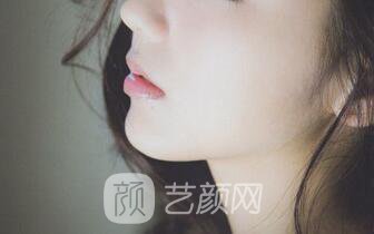 玻尿酸隆鼻+下巴之后，仿如新生，走上人生尖峰