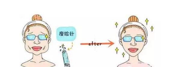 打注射瘦臉后臉真變小了，看來注射瘦臉真如傳聞所言