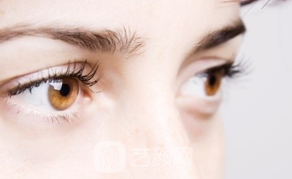 如何讓眼睛更美麗的雙眼皮手術(shù)？