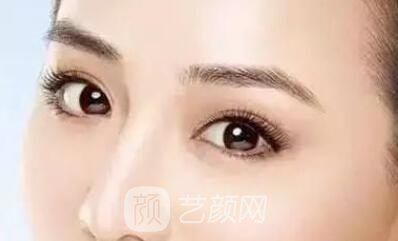 埋線雙眼皮的果不是******的？