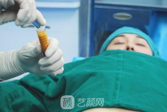 廉紅偉在水動(dòng)力吸脂方面有著嫻熟的手法，他的方法對(duì)身體傷害極小