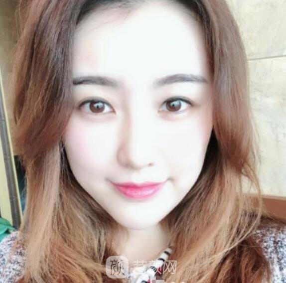 總體消化吸收的十分較為好,看上去看起來自身更年輕