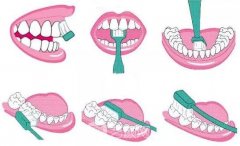 開講啦！種植牙護(hù)理大課堂鼓樓專場，上門就送598元大禮包！