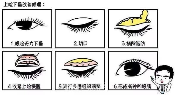  【眼部手術(shù)手術(shù)】九院眼部手術(shù)手術(shù)哪位醫(yī)生做的好？