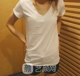 影響隆胸價格的要素有什么?