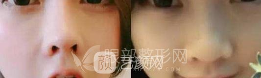 斗魚(yú)第一女主播馮提莫的進(jìn)化史：從素人到網(wǎng)紅！