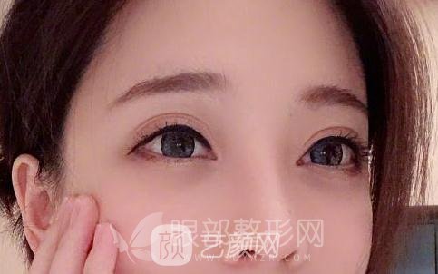 斗魚(yú)第一女主播馮提莫的進(jìn)化史：從素人到網(wǎng)紅！