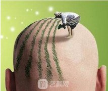 上海三甲醫(yī)院植發(fā)價格表