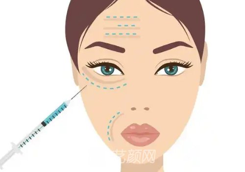 艾塑菲童顏針國(guó)內(nèi)多少錢(qián)