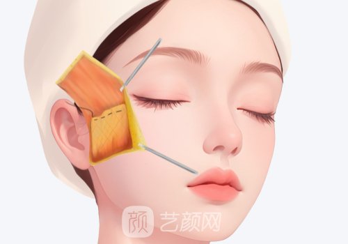 韓國美格真種植體保質(zhì)期