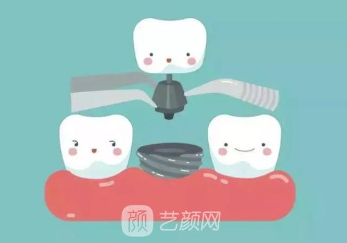 韓國仕諾康靠譜嗎?性能優(yōu)