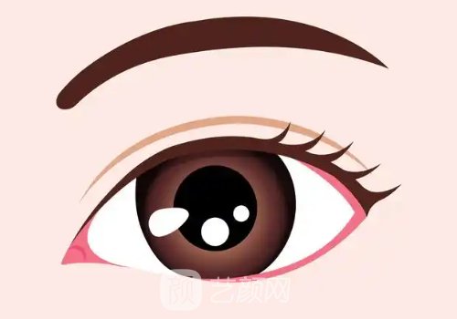 內(nèi)眼角回包多久恢復(fù)自然