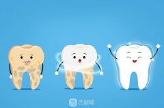 奧齒泰真實(shí)使用壽命：1