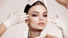 少女本色玻尿酸價格：單