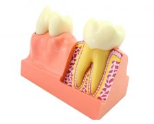 奧齒泰種植牙收費(fèi)價(jià)目表